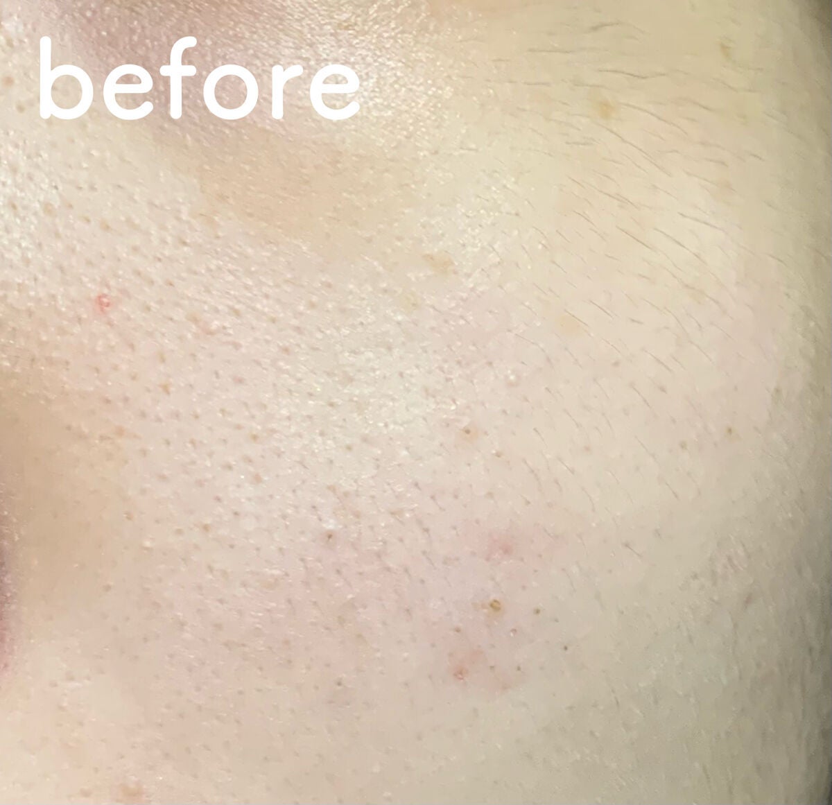 ももぷり フレッシュバブルパック/ももぷり/洗い流すパック・マスクを使ったクチコミ(5枚目)