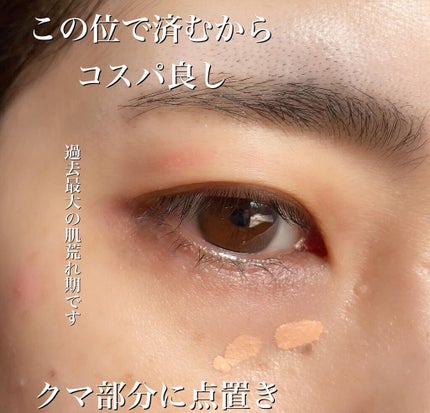 ラディアントクリーミー カラーコレクター/NARS/リキッドコンシーラーを使ったクチコミ(4枚目)