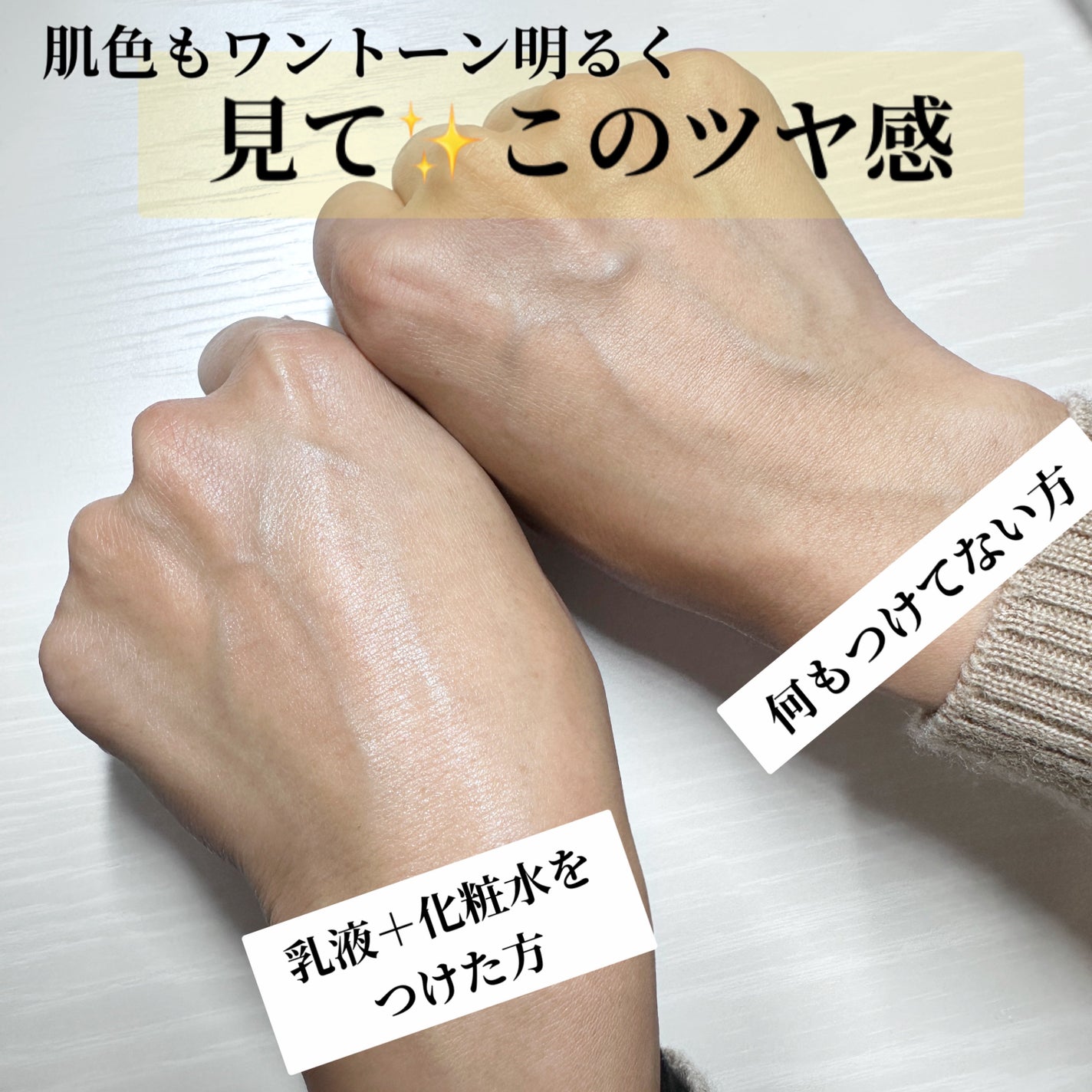 AQ アブソリュート エマルジョン マイクロラディアンス Ⅱ/DECORTÉ/乳液を使ったクチコミ(6枚目)