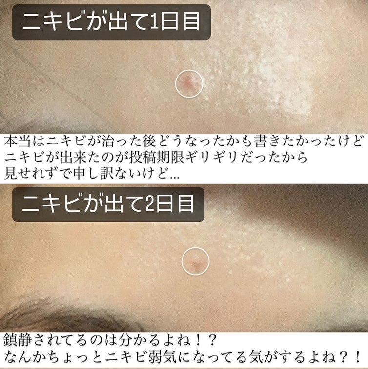 マジックカタツムリクリーム/ブラン/フェイスクリームを使ったクチコミ(4枚目)