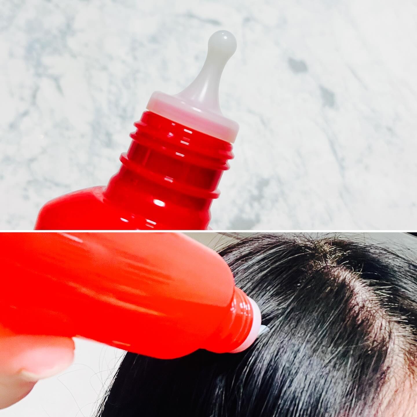 薬用 RJ地肌ケア エッセンス /アピセラピーコスメティクス/頭皮ローションを使ったクチコミ（2枚目）