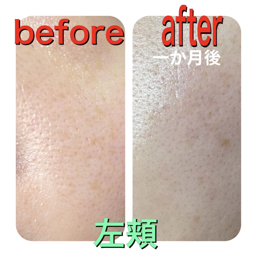 オバジC25セラムNEO/オバジ/美容液を使ったクチコミ（2枚目）