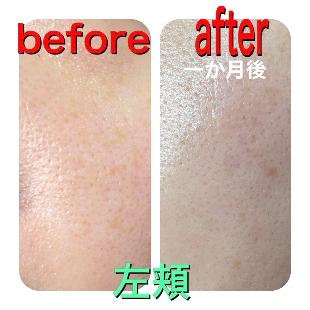 オバジC25セラムNEO/オバジ/美容液を使ったクチコミ(2枚目)