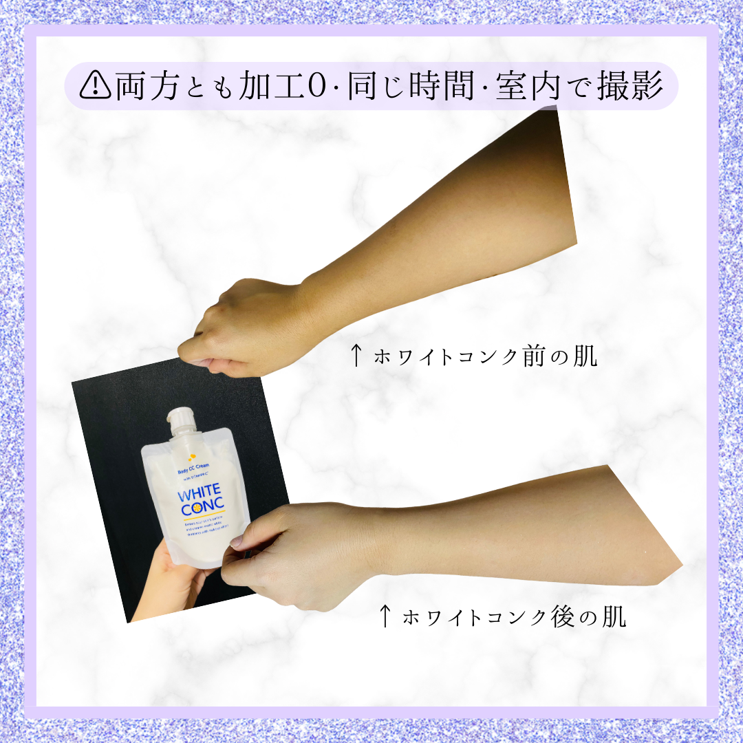 薬用ホワイトコンク ホワイトニングCC CII/ホワイトコンク/ボディクリームを使ったクチコミ(2枚目)