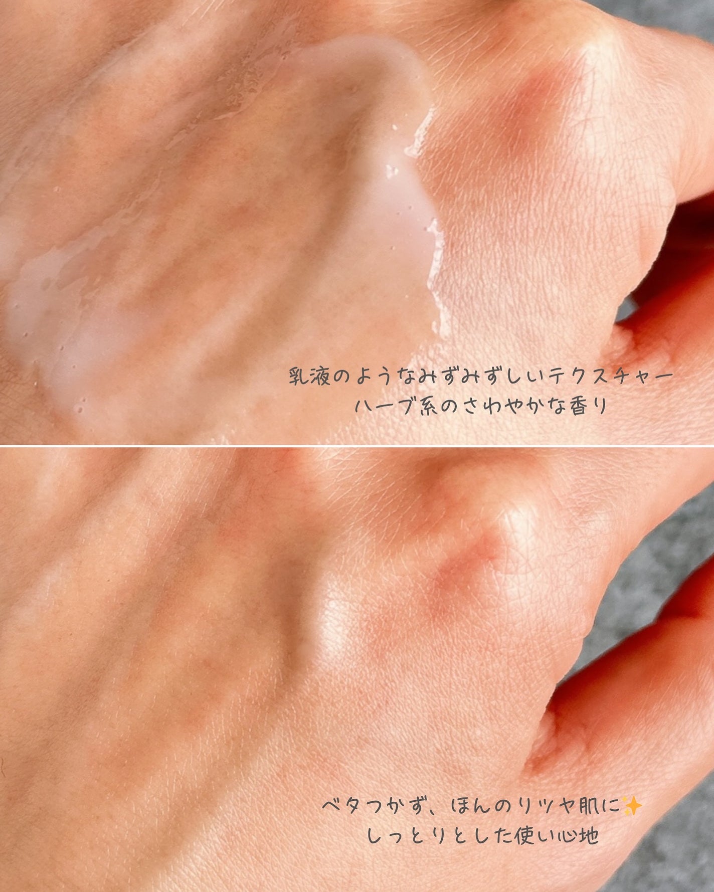 アゼペア 美容液/ネイチャーリパブリック/美容液を使ったクチコミ(3枚目)