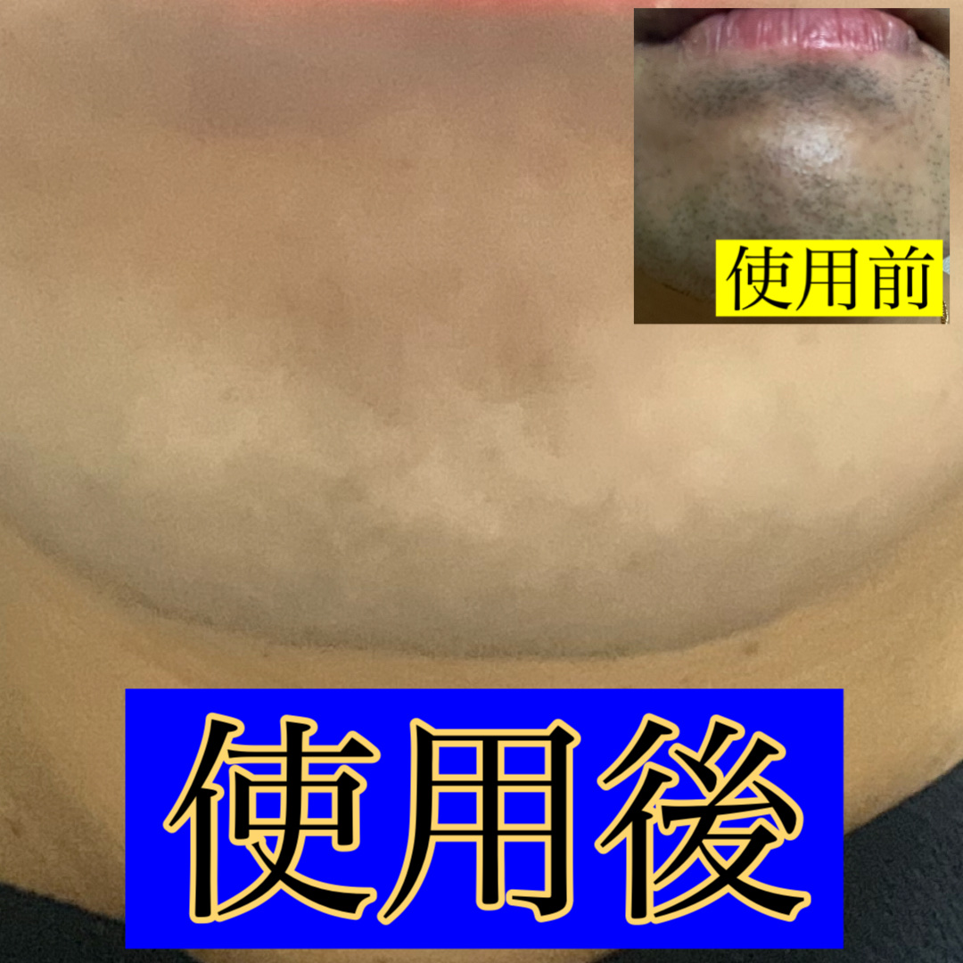 メサブルーリフレッシングブルージェル/MESAblue/フェイスクリームを使ったクチコミ（3枚目）