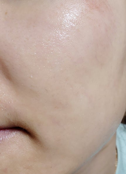 アビブ グルタチオンソームダークスポットセラムビタドロップ/Abib /美容液を使ったクチコミ(9枚目)