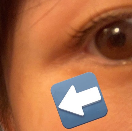 ダーマシンコンシーラー/23years old/リキッドコンシーラーを使ったクチコミ(2枚目)