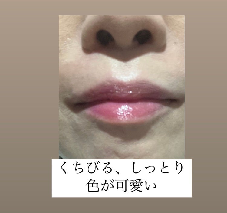 YNM キャンディーハニーリップバーム/YNM/リップバームを使ったクチコミ(5枚目)