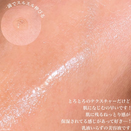 ドクダミ 77 スージングトナー/Anua/化粧水を使ったクチコミ(4枚目)