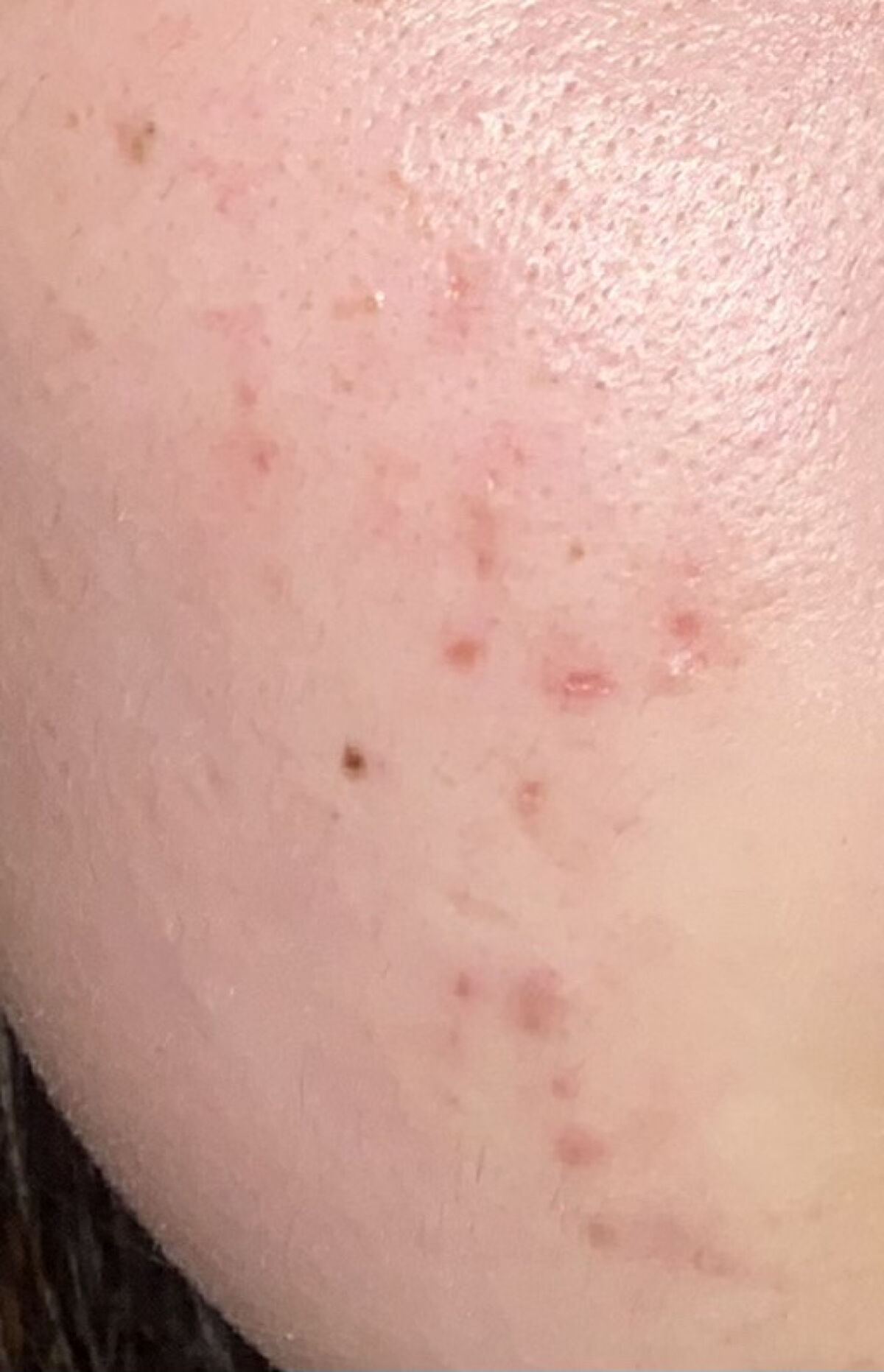 化粧水・敏感肌用・しっとりタイプ/無印良品/化粧水を使ったクチコミ（1枚目）