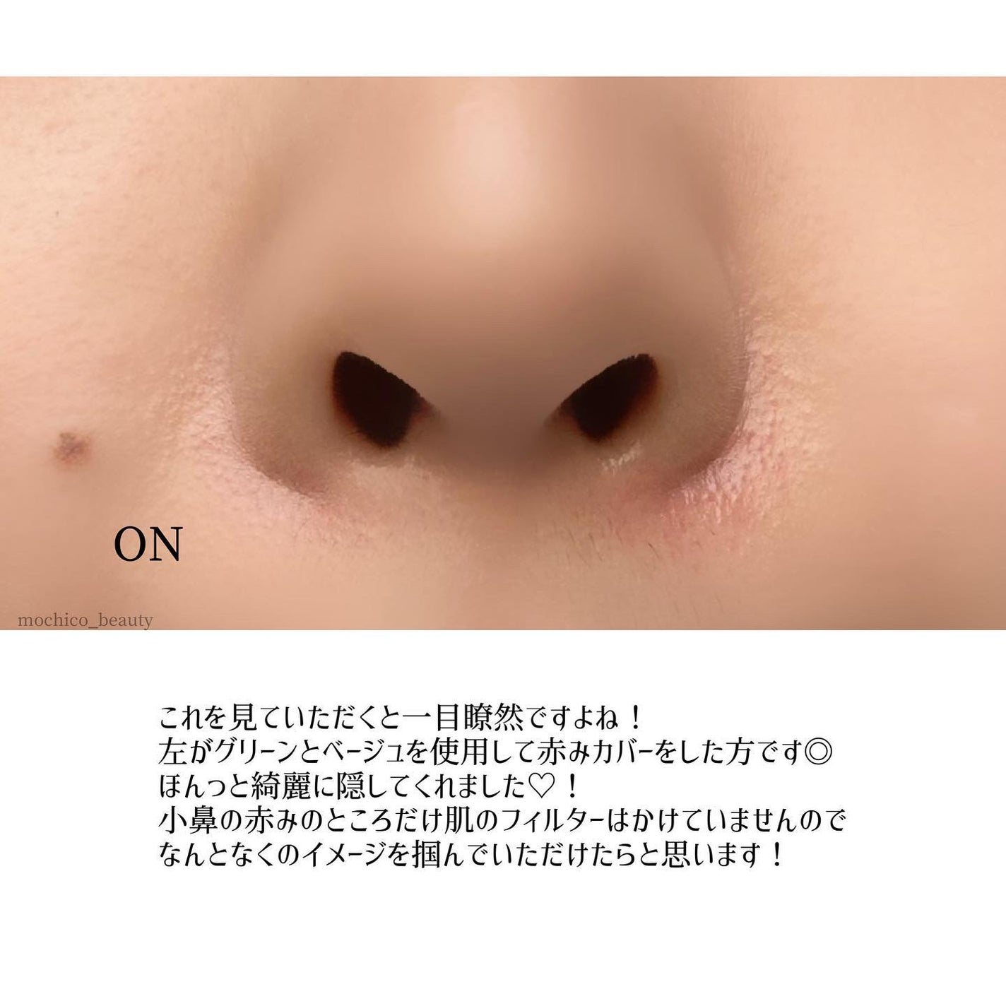 フーミー キニシーラー/WHOMEE/パレットコンシーラーを使ったクチコミ(5枚目)