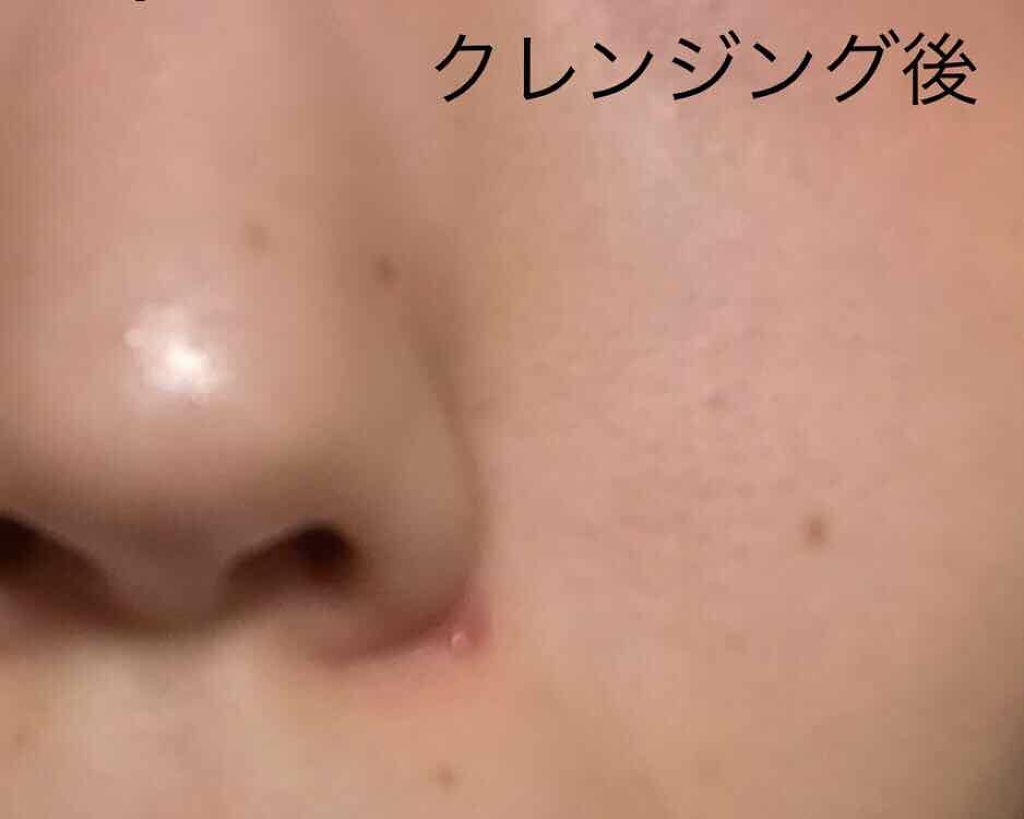 日本酒の化粧水/菊正宗/化粧水を使ったクチコミ(2枚目)