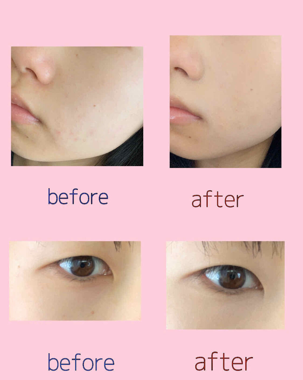 ストレッチコンシーラー/CEZANNE/リキッドコンシーラーを使ったクチコミ（2枚目）