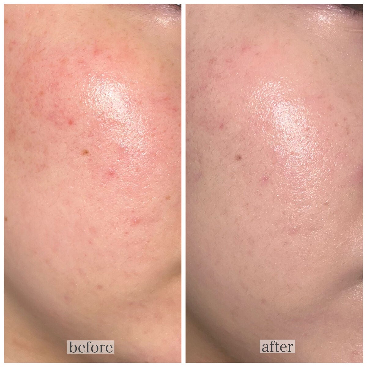 プレステージ ホワイト ル プロテクター UV ミネラル BB/Dior/BBクリームを使ったクチコミ(4枚目)