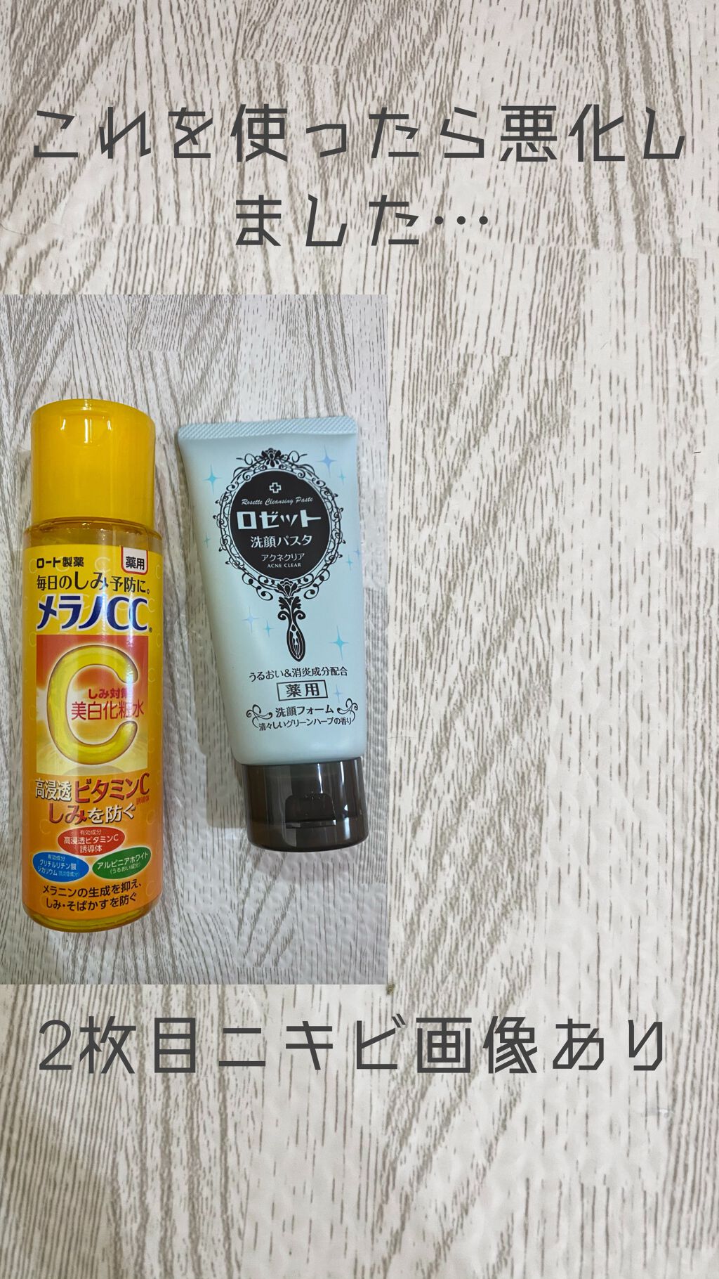 ロゼット洗顔パスタ アクネクリア/ロゼット/洗顔フォームを使ったクチコミ(1枚目)
