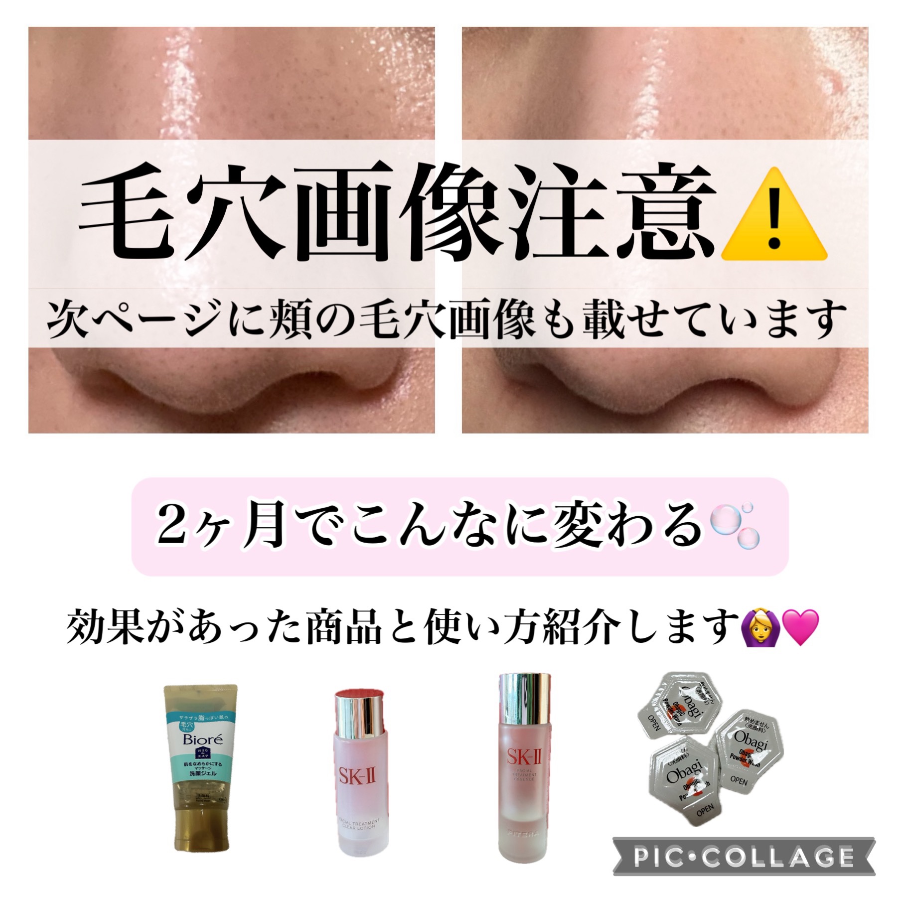 フェイシャル トリートメント エッセンス/SK-II/化粧水を使ったクチコミ（1枚目）