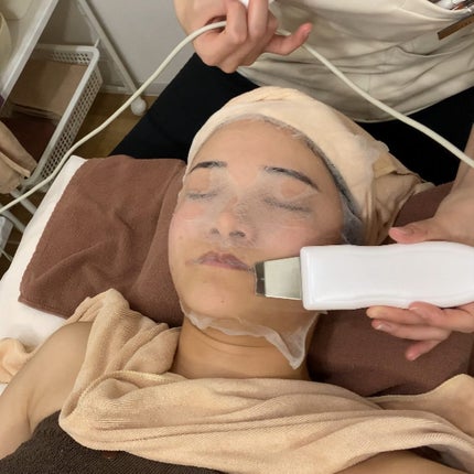 とものすけ🧸🍔 on LIPS 「ニキビ跡が気になって気になって仕方ないからニキビ専門サロンol..」(6枚目)