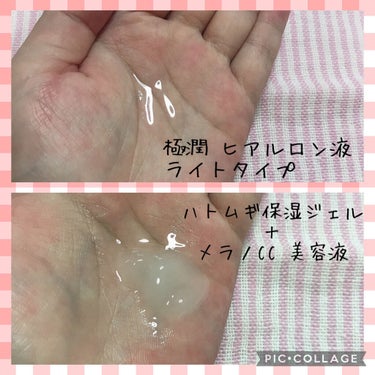 ピュアベール(医薬品)/プロペト/その他を使ったクチコミ（3枚目）