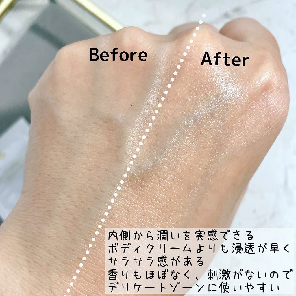 保湿ゲルクリーム/5001 Pro./デリケートゾーンケアを使ったクチコミ(5枚目)