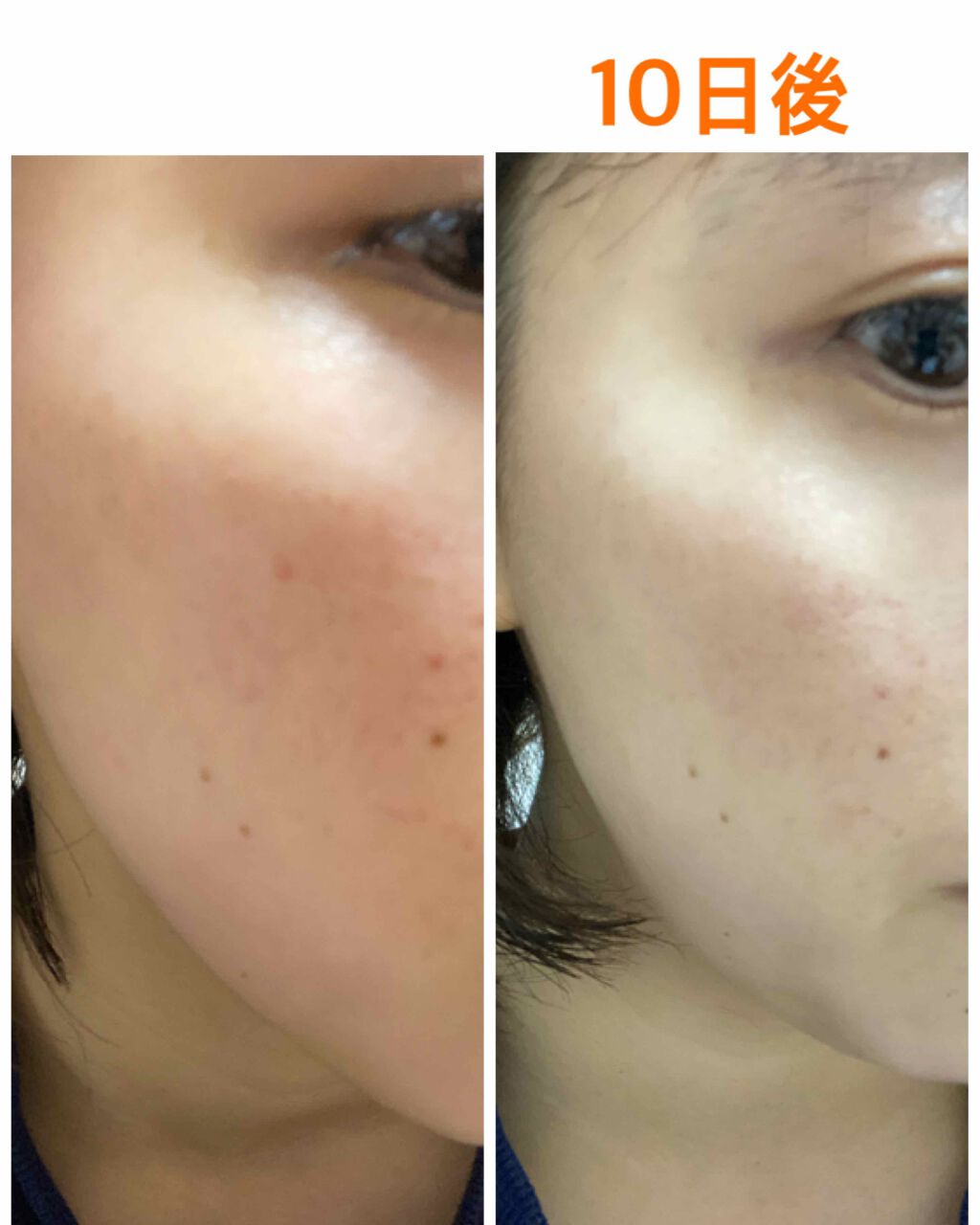 フレッシュリージュースドビタミンEマスク(90g)/Klairs/フェイスクリームを使ったクチコミ(4枚目)