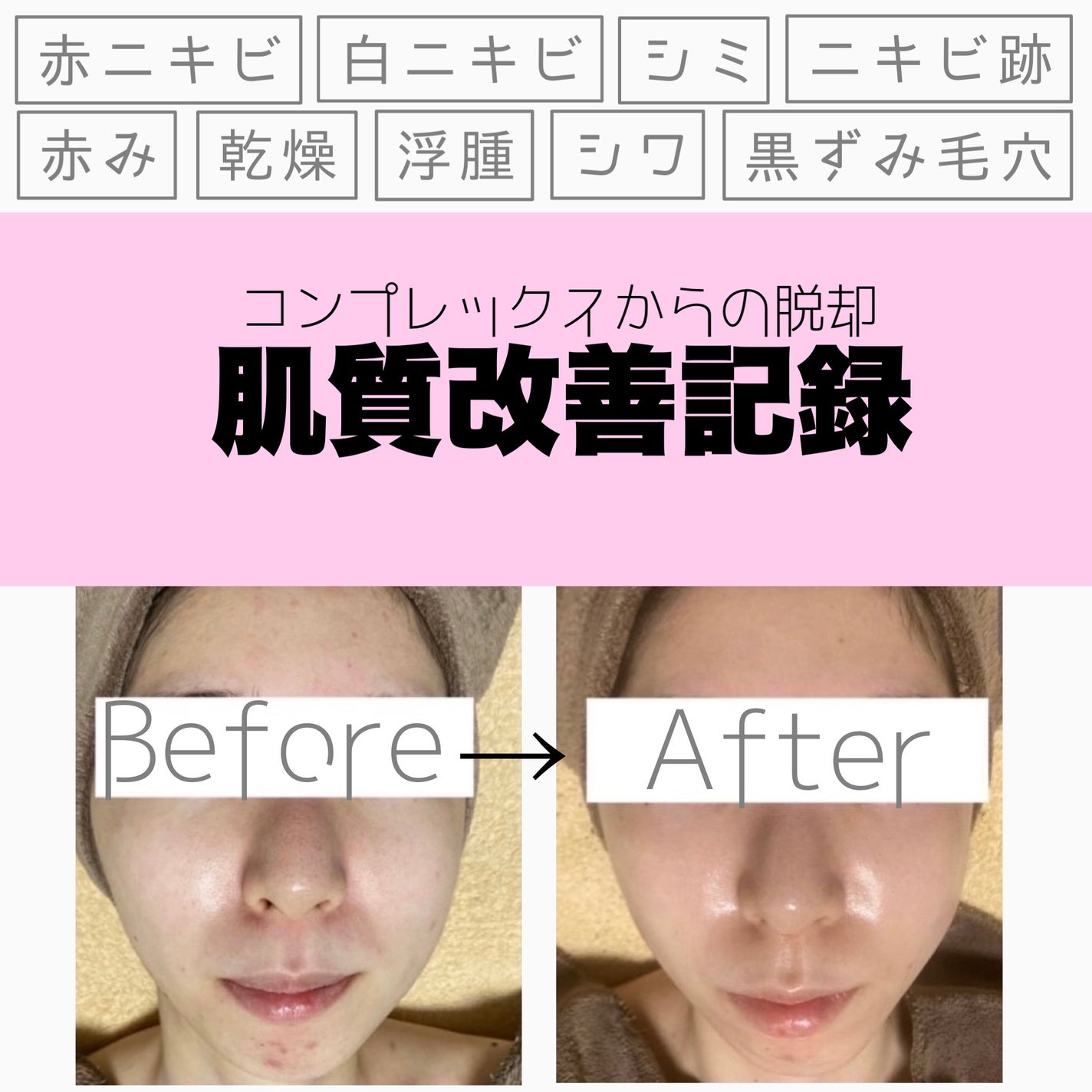 ããªãðãã©ãã on LIPS ãããããããç§ãã®ãèãå±¥ãæŽãð¿ãïŒçŸåš28æ³ïŒ29æ³ã®ä»£..ãïŒ1æç®ïŒ