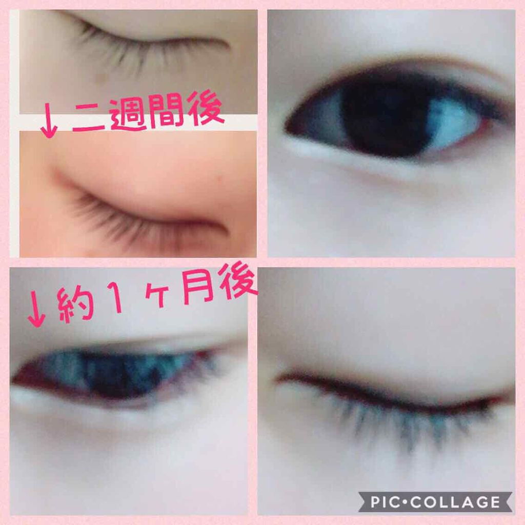 ローヤルゼリー配合 栄養ローション/DAISO/美容液を使ったクチコミ（2枚目）