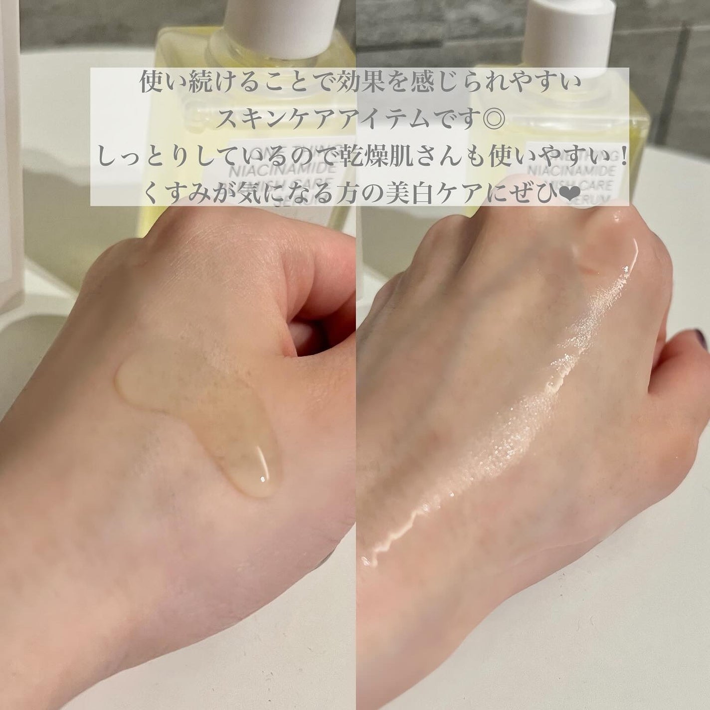ナイアシンアミドブレミッシュケアセラム/ONE THING/美容液を使ったクチコミ(4枚目)