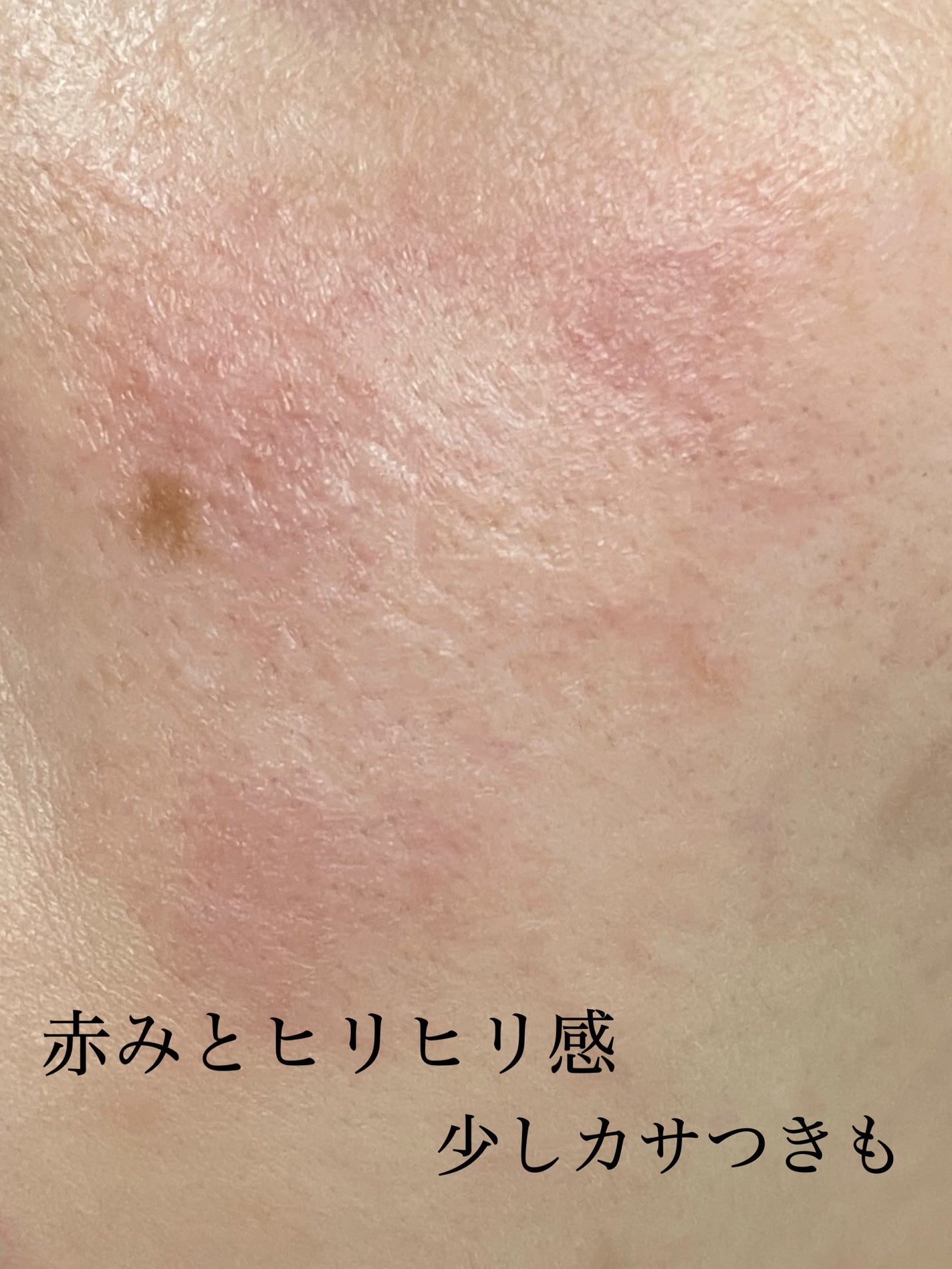 ナチュラルパック /MIRANAL/洗い流すパック・マスクを使ったクチコミ(4枚目)