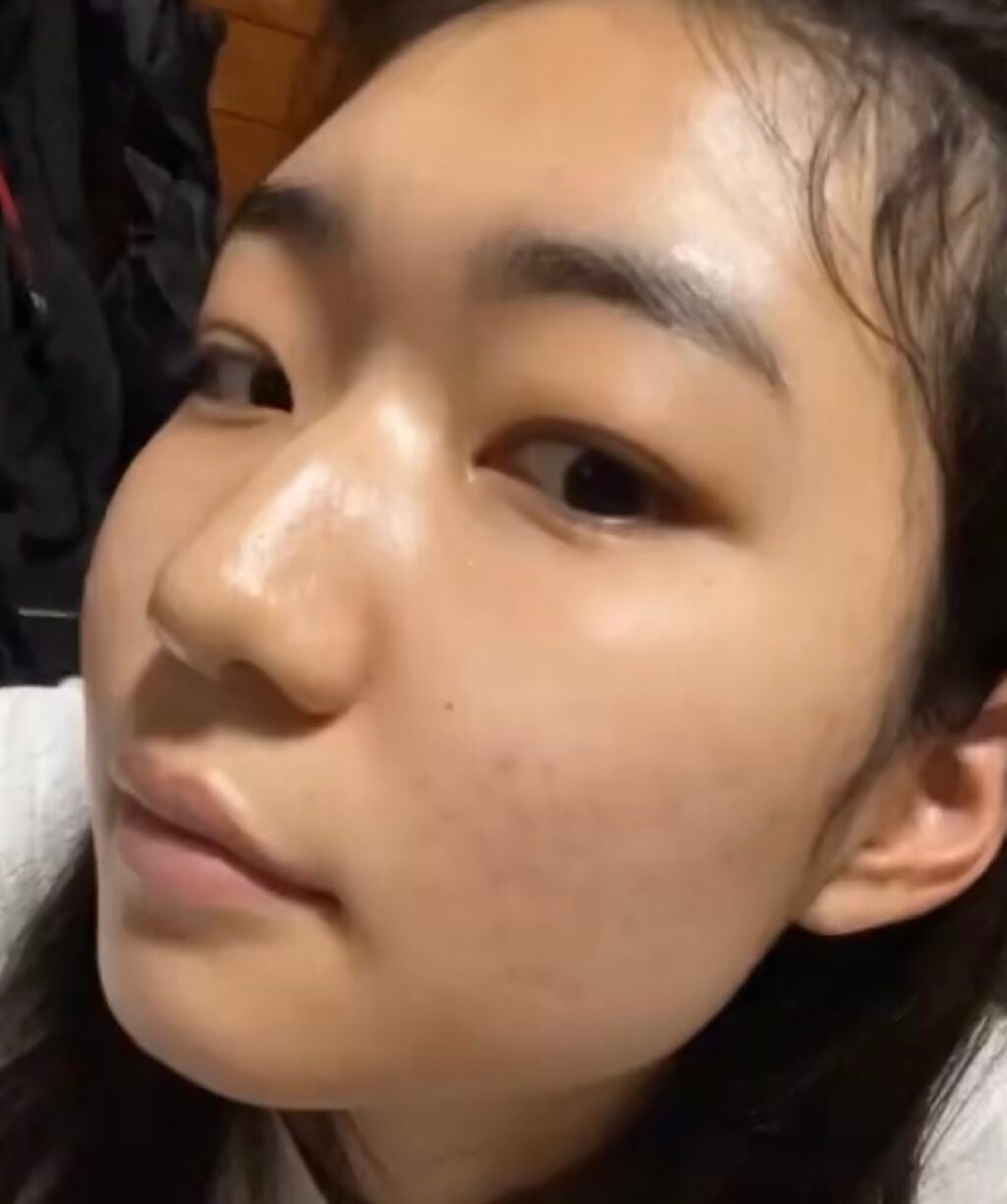 紫月 on LIPS 「汚い汚いと言われたお肌日記(1枚目→去年9月、2枚目→去年の1..」(4枚目)