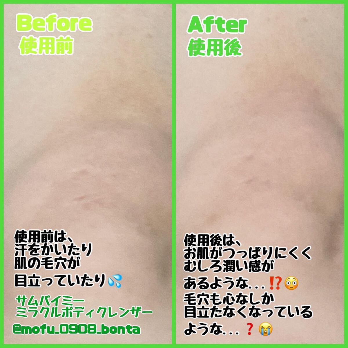 AHA·BHA·PHA 30デイズミラクルアクネボディクレンザー/SOME BY MI/ボディソープを使ったクチコミ（3枚目）