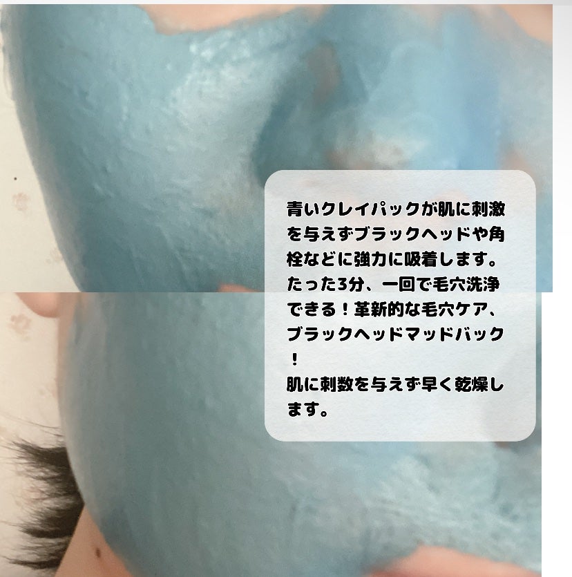 ゼロ毛穴パッド 2.0/MEDICUBE/トナーパッドを使ったクチコミ(5枚目)