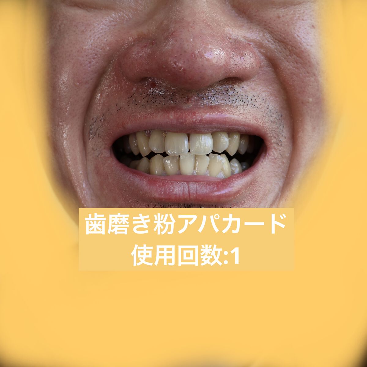 を使ったクチコミ（1枚目）