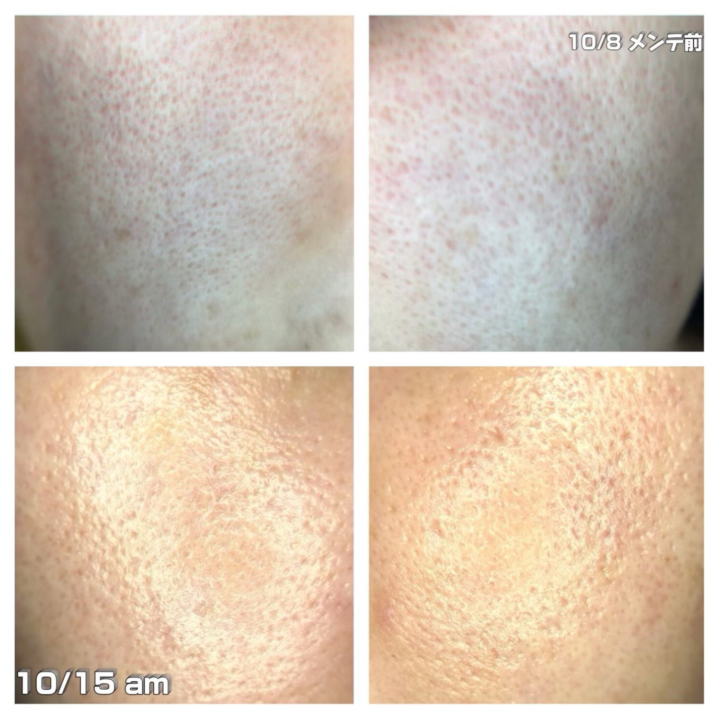 レチノショット 0.1/TOUT VERT/フェイスクリームを使ったクチコミ(3枚目)