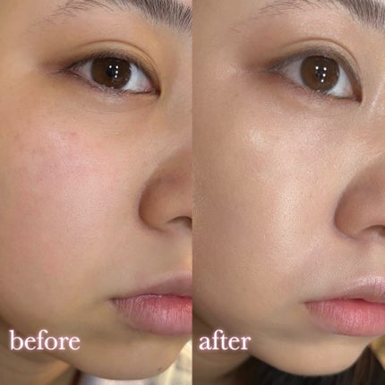 ピンクティーツリーカバープライマークッション/APLIN/クッションファンデーションを使ったクチコミ(5枚目)