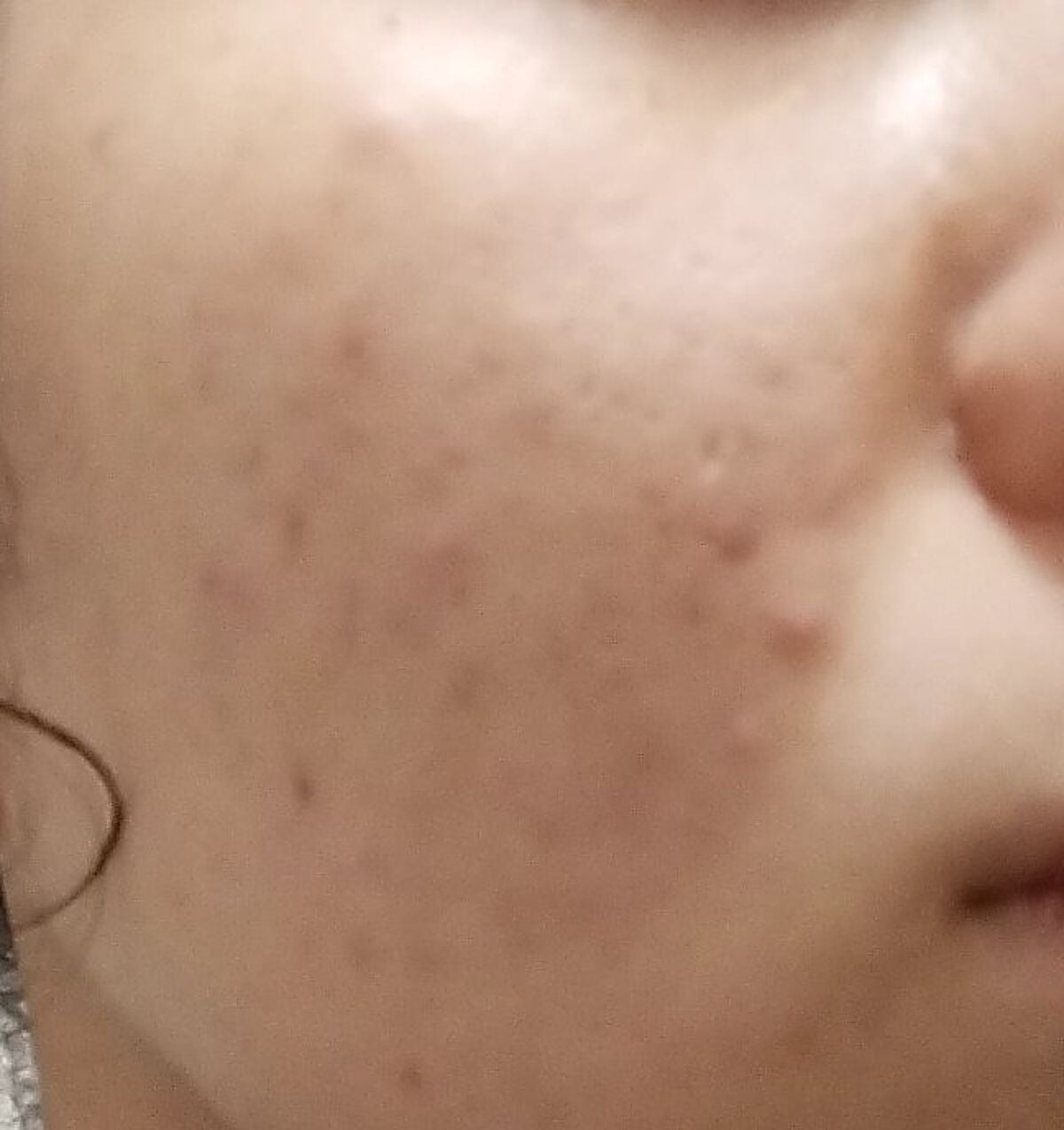 アイスエッセンス 0/BENEFIQUE/美容液を使ったクチコミ(3枚目)