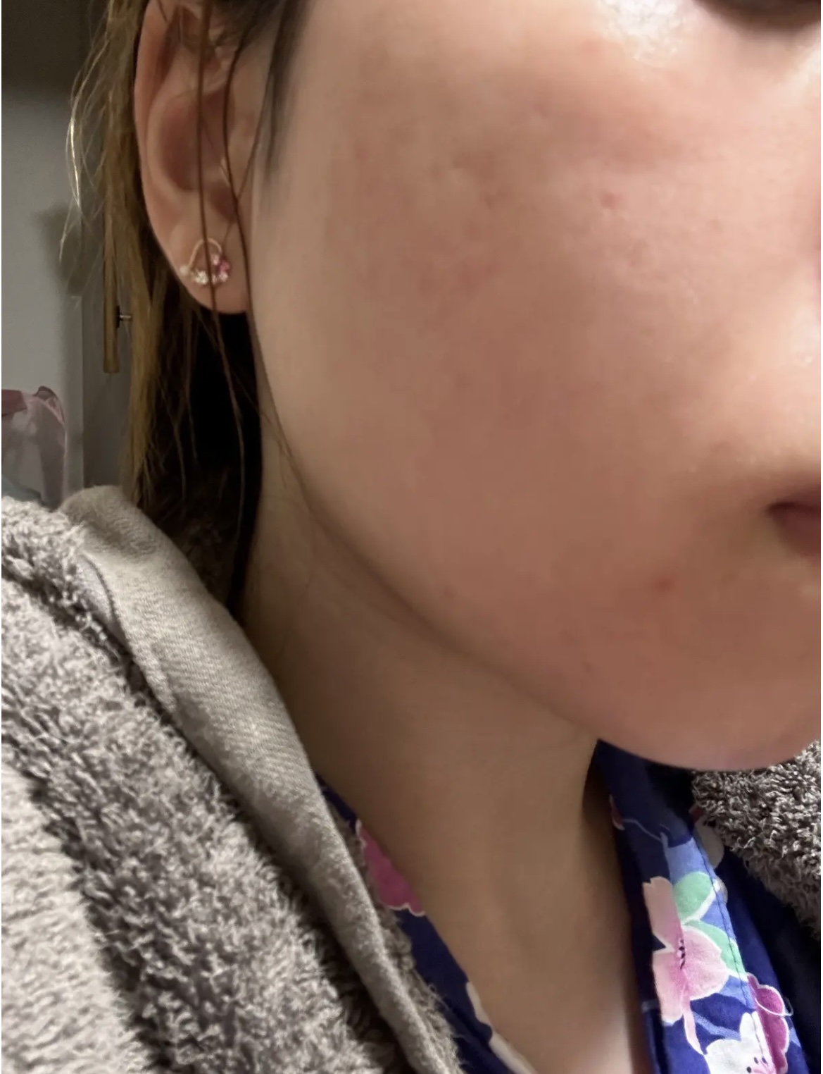 ヴィオテラス Cセラム/ヘルスビューティー/美容液を使ったクチコミ（1枚目）