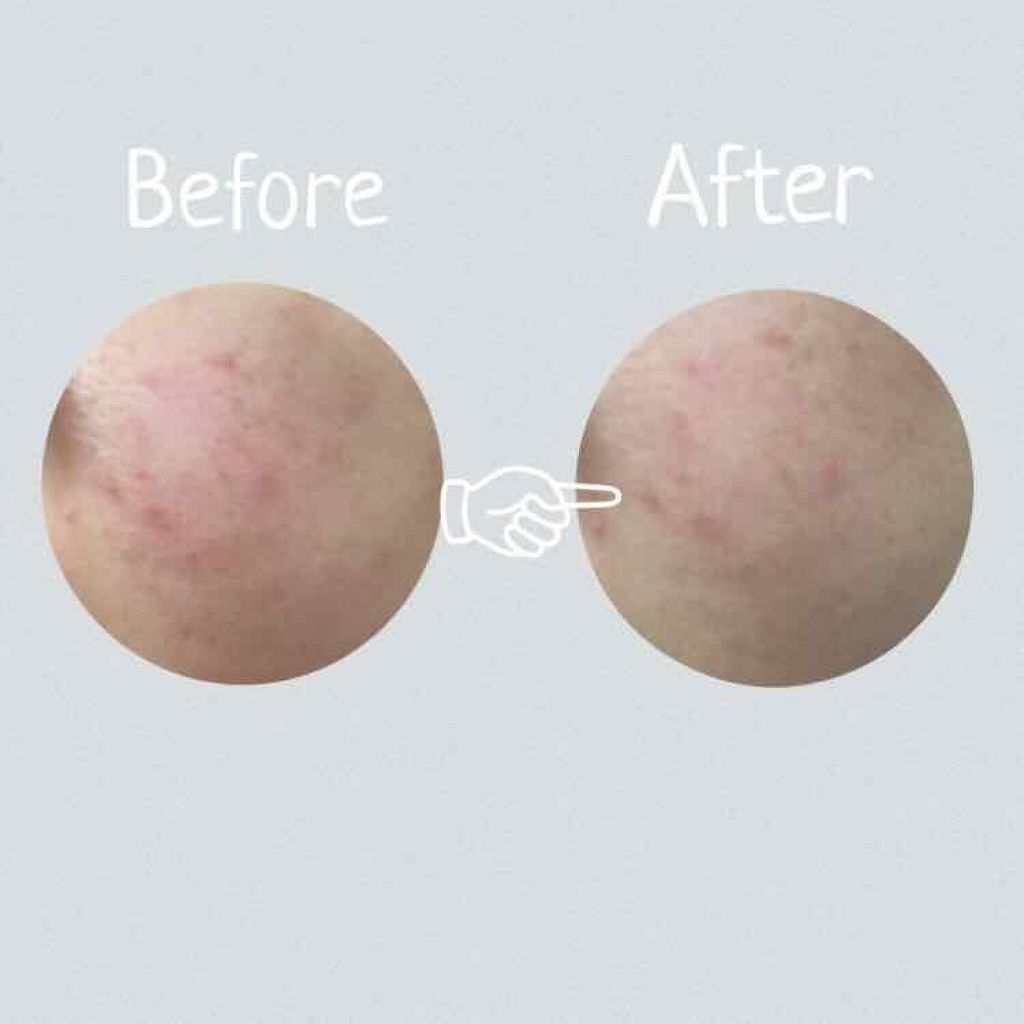 メイクアップベースS(グリーン)/media/化粧下地を使ったクチコミ（3枚目）