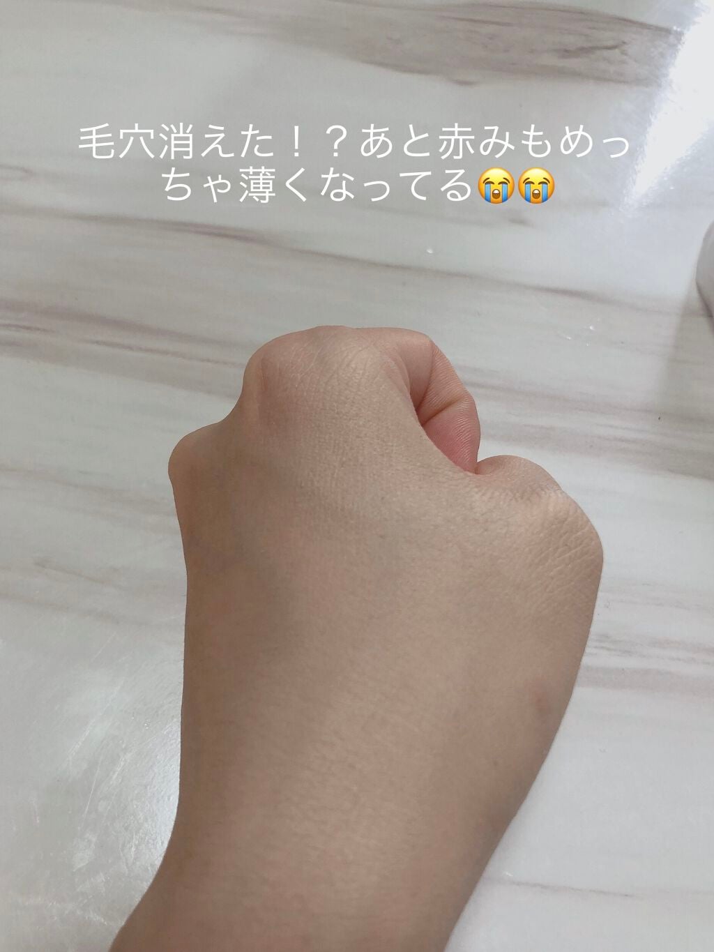 ドクタージャルト シカペア リカバー (第2世代)/Dr.Jart+/フェイスクリームを使ったクチコミ(3枚目)