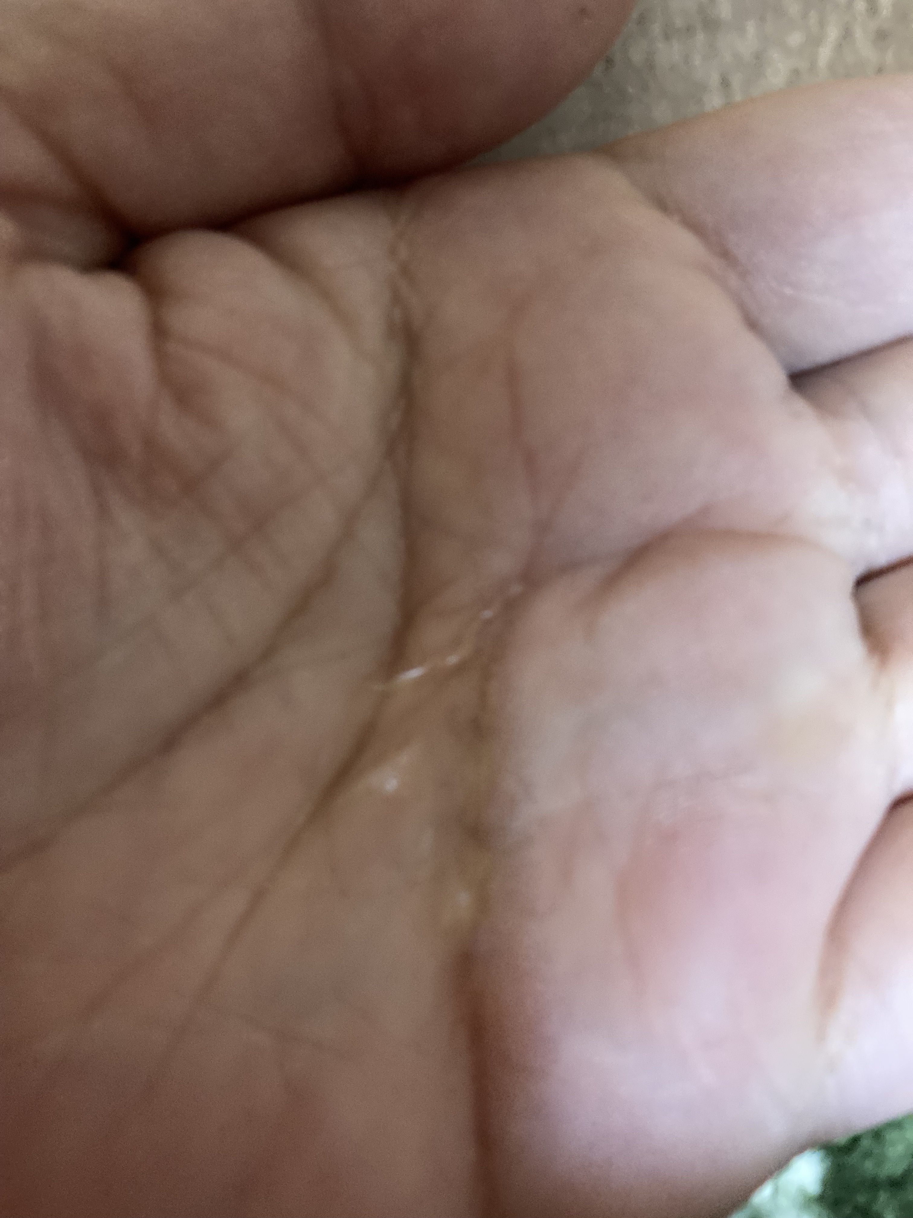 ダーマレーザー ウルセラC/クオリティファースト/美容液を使ったクチコミ（3枚目）