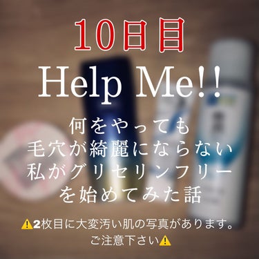 今日でグリセリンフリーをスタートしてから
10日経ちました☺️

2枚目は初めてLIPSに投稿した日の肌と今日の肌です

仕事場でずっとマスクをしていて、休憩時間に撮っているので日によって鼻の毛穴の開き