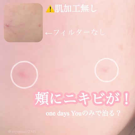 ヘルプミー! ダクトパッド/One-day's you/トナーパッドを使ったクチコミ(2枚目)