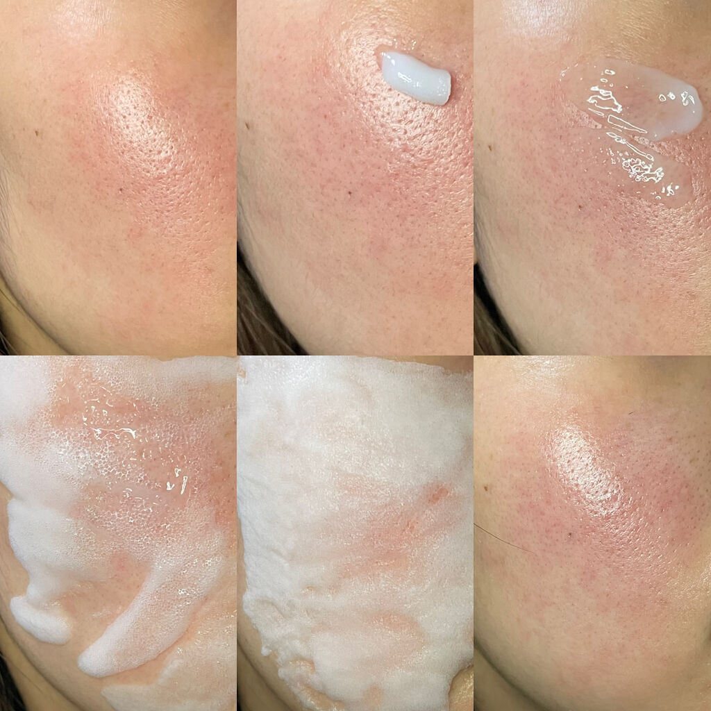 マジックバブルエッセンスパックMINI/BAKER7/シートマスク・パックを使ったクチコミ（2枚目）