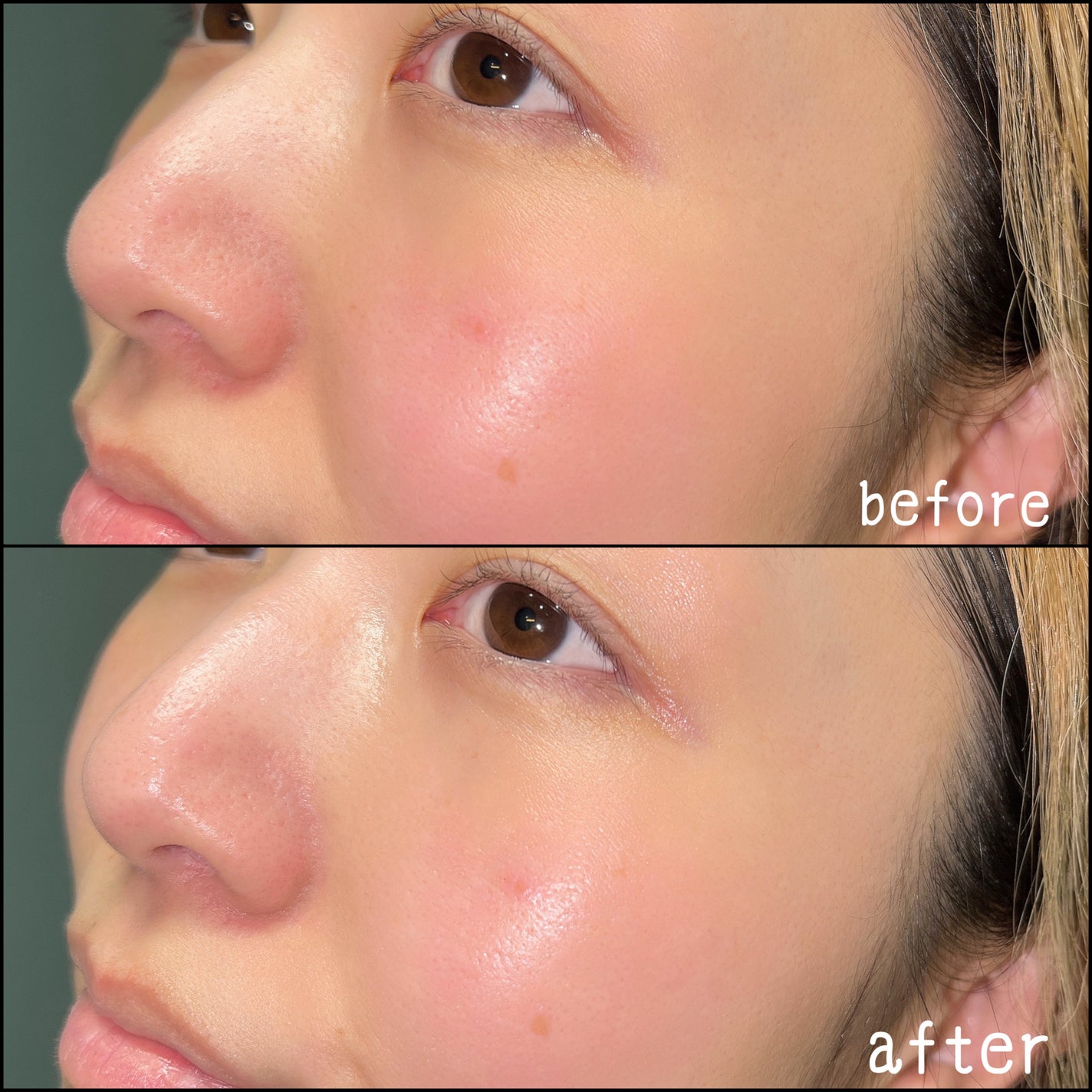 ガラクナイアシン77アンプルエッセンス /LOVANDUE/美容液を使ったクチコミ(4枚目)