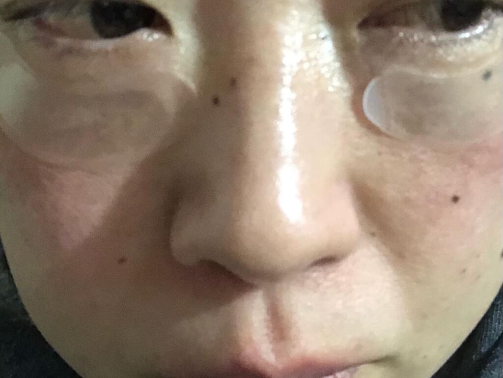 NEEDROP/NISSHA/シートマスク・パックを使ったクチコミ(5枚目)