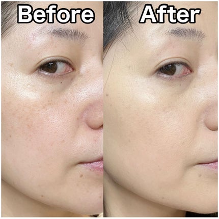 タンイドル ウルトラ ウェア リキッド/LANCOME/リキッドファンデーションを使ったクチコミ(10枚目)