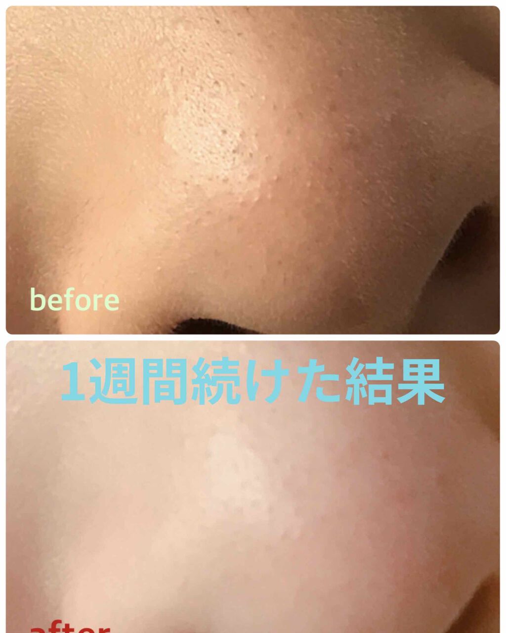 ホホバオイル/無印良品/ボディオイルを使ったクチコミ（3枚目）