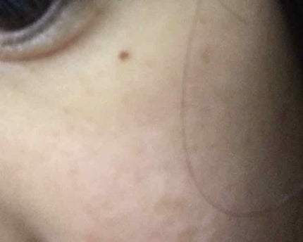 白潤プレミアム 薬用浸透美白化粧水/肌ラボ/化粧水を使ったクチコミ(2枚目)