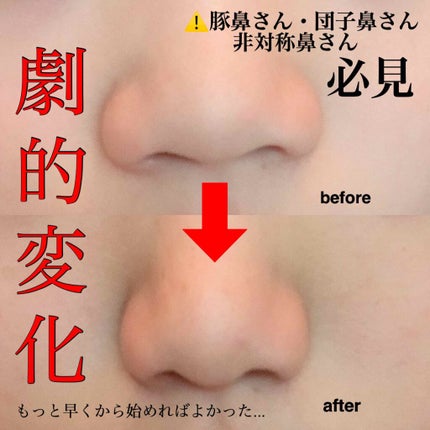 ReFa S CARAT/ReFa/美顔器・マッサージを使ったクチコミ(1枚目)