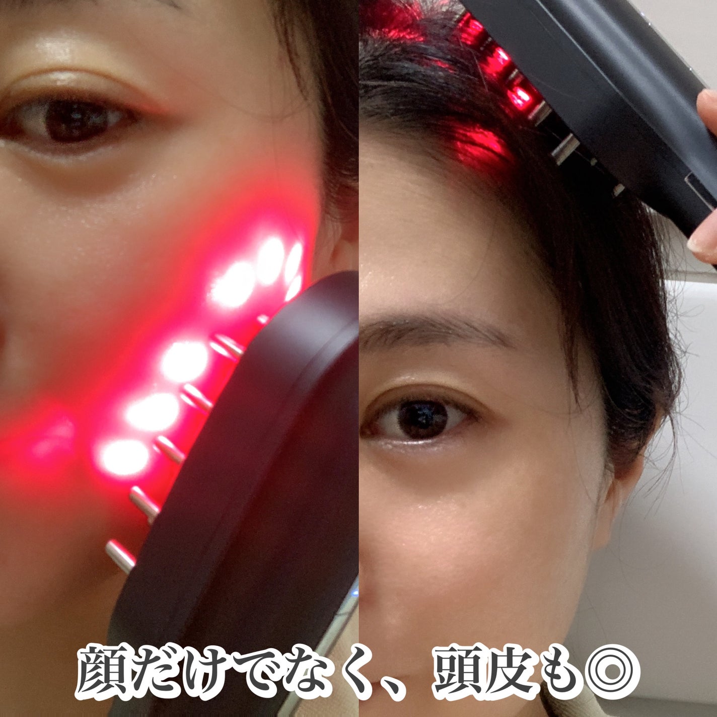 ステラボーテ レーザー & EMSリフトブラシPRO|STELLA BEAUTEの ステラボーテ レーザー & EMSリフトブラシPRO|STELLA BEAUTEの